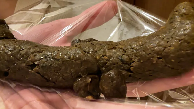 ウンコが出る日常 三浦はなのサンプル画像